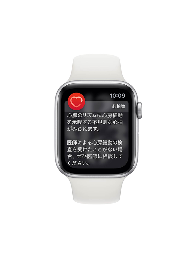 日本でもApple Watchで心電図アプリ（ECGアプリ）が提供されるようになりました。