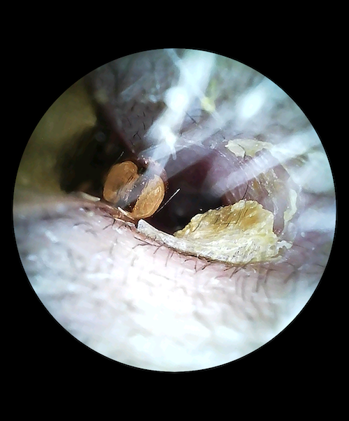 bebird EarSight Ultra X アプリを使った耳垢掃除